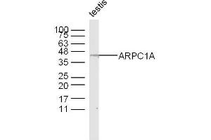 Image no. 1 for anti-Actin Related Protein 2/3 Complex, Subunit 1A, 41kDa (ARPC1A) (AA 101-200) antibody (ABIN1714292)
