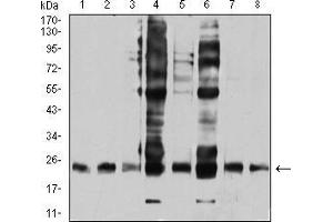 Image no. 5 for anti-V-Ral Simian Leukemia Viral Oncogene Homolog B (Ras Related, GTP Binding Protein) (Ralb) (AA 89-206) antibody (ABIN5542685)