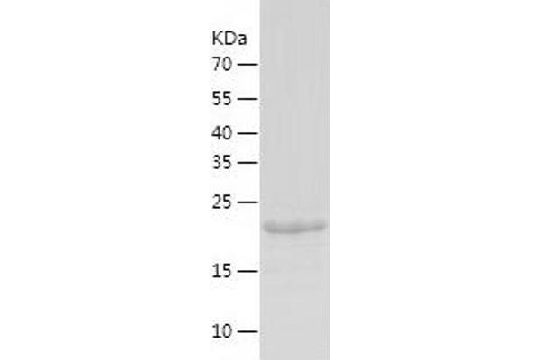 NOL3 Protein (AA 1-208) (His tag)