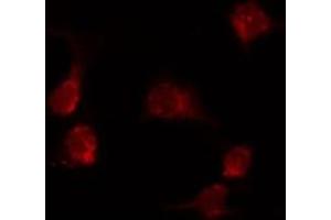 Image no. 2 for anti-KDEL (Lys-Asp-Glu-Leu) Endoplasmic Reticulum Protein Retention Receptor 1 (KDELR1) (Internal Region) antibody (ABIN6262763)