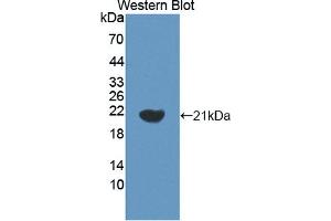Image no. 2 for anti-Helicase-Like Transcription Factor (HLTF) (AA 831-990) antibody (ABIN5013679)