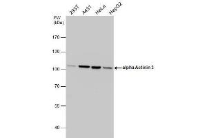 Image no. 2 for anti-Actinin, alpha 3 (ACTN3) (Center) antibody (ABIN2855581)
