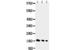 Image no. 1 for anti-Interleukin 4 (IL4) (AA 123-140), (C-Term) antibody (ABIN3043168)