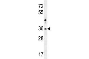 Image no. 1 for anti-NK1 Homeobox 2 (NKX1-2) (AA 1-2) antibody (ABIN3028869)