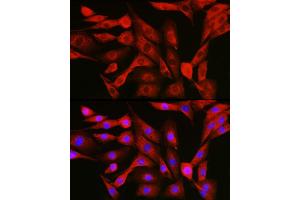 Image no. 7 for anti-Nuclear Factor of kappa Light Polypeptide Gene Enhancer in B-Cells 1 (NFKB1) (AA 740-964) antibody (ABIN6144571)