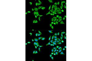 Image no. 1 for anti-Carboxylesterase 2 (CES2) (pSer2) antibody (ABIN3022048)
