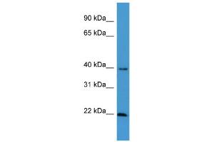 Image no. 2 for anti-Estrogen Receptor Binding Site Associated, Antigen, 9 (EBAG9) (C-Term) antibody (ABIN2788244)