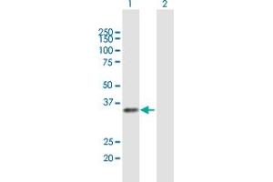 Image no. 1 for anti-Regulatory Factor X-Associated Protein (RFXAP) (AA 1-272) antibody (ABIN948405)