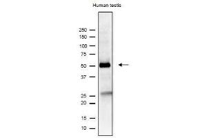 Image no. 4 for anti-Izumo Sperm-Egg Fusion 1 (IZUMO1) antibody (ABIN2452040)