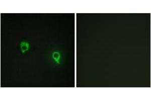 Image no. 3 for anti-A Kinase (PRKA) Anchor Protein 1 (AKAP1) (AA 281-330) antibody (ABIN1534039)