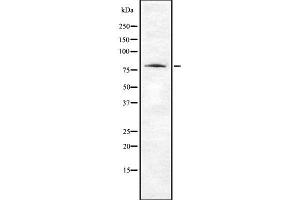 Image no. 1 for anti-Abl-Interactor 2 (ABI2) (Internal Region) antibody (ABIN6259703)