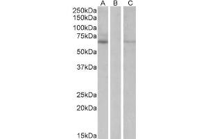 Image no. 1 for anti-Makorin Ring Finger Protein 1 (MKRN1) (Internal Region) antibody (ABIN5539936)