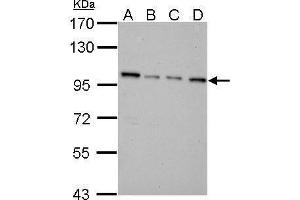 Image no. 4 for anti-Nicotinamide Nucleotide Transhydrogenase (NNT) (C-Term) antibody (ABIN2855538)
