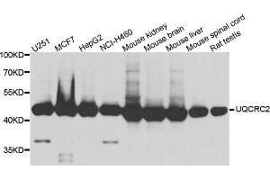 Image no. 1 for anti-Ubiquinol-Cytochrome C Reductase Core Protein II (UQCRC2) antibody (ABIN1683222)