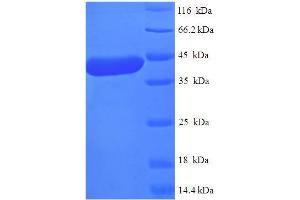 Image no. 1 for Methyltransferase Like 11A (METTL11A) (AA 1-223), (full length) protein (His-SUMO Tag) (ABIN5711881)