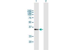 Image no. 1 for anti-Retinol Dehydrogenase 12 (All-Trans/9-Cis/11-Cis) (RDH12) (AA 1-316) antibody (ABIN949859)