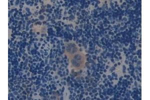 Detection of MUC1 in Mouse Spleen Tissue using Polyclonal Antibody to Mucin 1 (MUC1)
