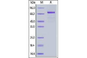 Image no. 2 for Interleukin 5 Receptor, alpha (IL5RA) (AA 21-342) (Active) protein (Fc Tag) (ABIN6938892)