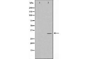 Image no. 3 for anti-Replication Protein A2, 32kDa (RPA2) (pThr21) antibody (ABIN6255629)
