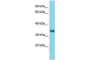 Image no. 1 for anti-Homer Homolog 2 (HOMER2) (C-Term) antibody (ABIN2788910)