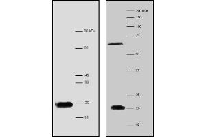 Image no. 1 for anti-Processing of Precursor 7, Ribonuclease P/MRP Subunit (POP7) antibody (ABIN1108698)