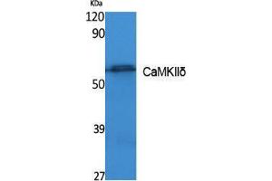 Image no. 1 for anti-Calcium/calmodulin-Dependent Protein Kinase II delta (CAMK2D) (Internal Region) antibody (ABIN3180971)
