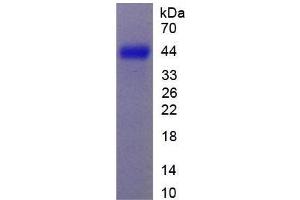 Image no. 1 for Chondroitin Sulfate Proteoglycan 5 (Neuroglycan C) (CSPG5) protein (ABIN3008776)
