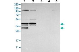 Image no. 1 for anti-EBNA1 Binding Protein 2 (EBNA1BP2) antibody (ABIN5576965)