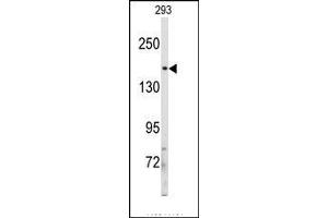 Image no. 1 for anti-Insulin Receptor Substrate 2 (IRS2) (C-Term) antibody (ABIN360098)