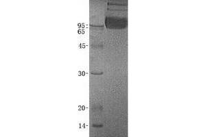 Image no. 1 for Osteoactivin (GPNMB) (Transcript Variant 1) protein (ABIN2722180)