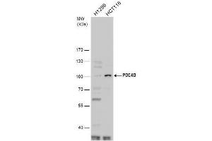 Image no. 2 for anti-phosphodiesterase 4B, cAMP-Specific (PDE4B) (C-Term) antibody (ABIN2855498)