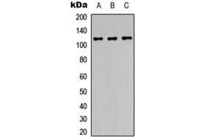 Image no. 1 for anti-Protein Phosphatase 1, Regulatory Subunit 13B (PPP1R13B) (Center) antibody (ABIN2706857)