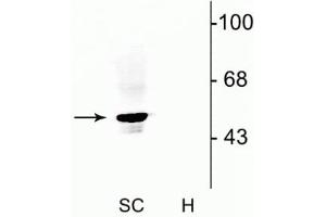 Image no. 2 for anti-Glycine Receptor, alpha 1 (GLRA1) (N-Term) antibody (ABIN361432)