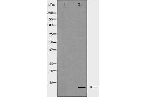Image no. 1 for anti-S100 Calcium Binding Protein A10 (S100A10) (Internal Region) antibody (ABIN6264895)