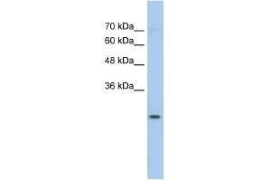 Image no. 1 for anti-Glutathione S-Transferase mu 1 (GSTM1) (N-Term) antibody (ABIN2776984)