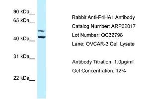 Image no. 1 for anti-Prolyl 4-Hydroxylase, alpha Polypeptide I (P4HA1) (Middle Region) antibody (ABIN2788990)