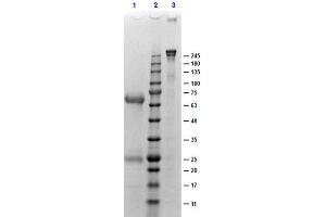 Image no. 2 for gamma Globulin Fraction protein (ABIN964142)