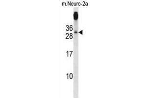 Image no. 2 for anti-TGFB-Induced Factor Homeobox 2 (TGIF2) (AA 170-199), (C-Term) antibody (ABIN955180)