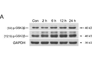 Image no. 72 for anti-Glyceraldehyde-3-Phosphate Dehydrogenase (GAPDH) (Center) antibody (ABIN2857072)