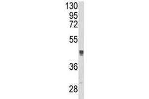 Image no. 3 for anti-Trans-Golgi Network Protein 2 (TGOLN2) (AA 399-427) antibody (ABIN3029193)