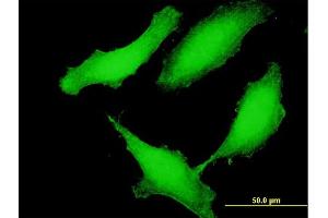 Immunofluorescence of purified MaxPab antibody to CCDC115 on HeLa cell.