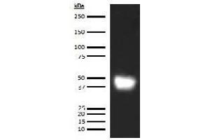 Image no. 2 for anti-Leucine-Rich alpha-2 Glycoprotein 1 (LRG1) antibody (ABIN5567230)