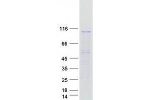 Image no. 1 for SEC63 Homolog (SEC63) protein (Myc-DYKDDDDK Tag) (ABIN2731582)