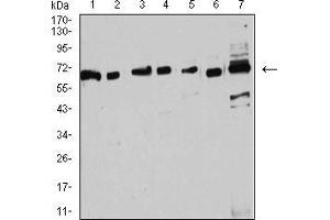 anti-Estrogen Receptor 1 (ESR1) (AA 2-185) antibody