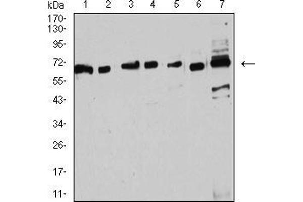 anti-Estrogen Receptor 1 (ESR1) (AA 2-185) antibody