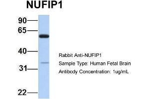 Image no. 1 for anti-Nuclear Fragile X Mental Retardation Protein Interacting Protein 1 (NUFIP1) (N-Term) antibody (ABIN2776495)
