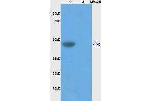 Image no. 3 for anti-Cell Adhesion Molecule 1 (CADM1) (AA 70-120) antibody (ABIN761351)