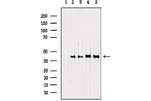 Image no. 2 for anti-NAD(P) Dependent Steroid Dehydrogenase-Like (NSDHL) (Internal Region) antibody (ABIN6263742)