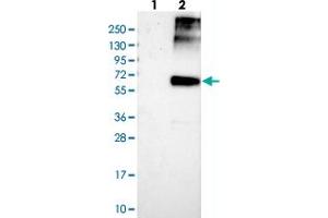 Image no. 1 for anti-Asparagine-Linked Glycosylation 9, alpha-1,2-Mannosyltransferase (ALG9) antibody (ABIN5572412)