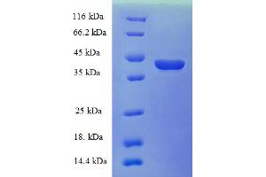 Image no. 1 for Cellular Retinoic Acid Binding Protein 1 (CRABP1) (AA 2-137) protein (GST tag) (ABIN5709319)
